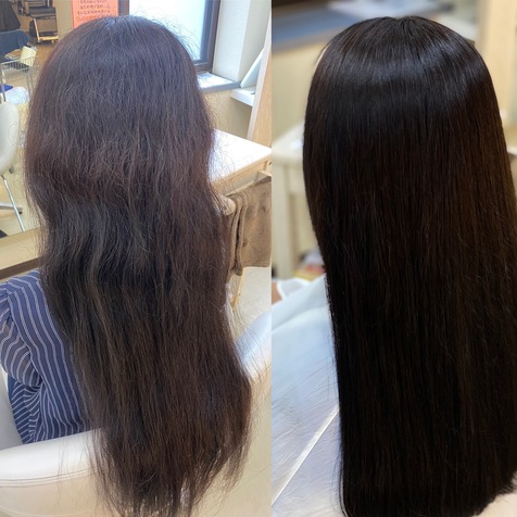 うねりが酷くてとにかく抑えたい方へ